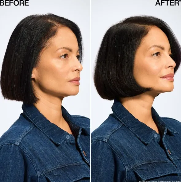 Acidic Grow Full System Instant Densifying Spray for Thin Hair