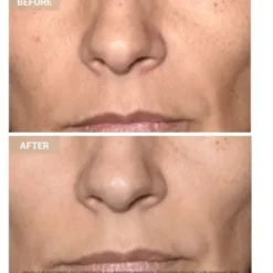Anti-Aging LED Face Mask The Professional - Anti-aging LED-ansiktsmask