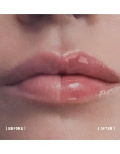 Filorga Hyalu-Filler Lips 4g