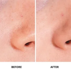 Ginseng Micro Shot 0. 1 - Omstrukturerande serum med mikroinfusion