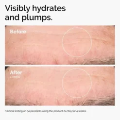Hyaluronic Acid 2% + B5