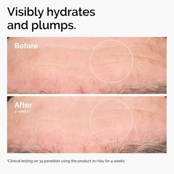 Hyaluronic Acid 2% + B5