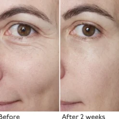 Hyaluronic Global Serum