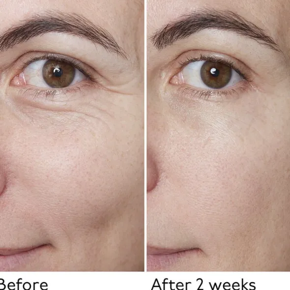 Hyaluronic Global Serum