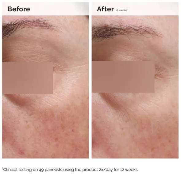 Niacinamide 5% Face and Body Emulsion