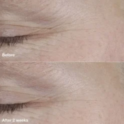 Smart Clinical Repair AM/PM Retinoid Balm