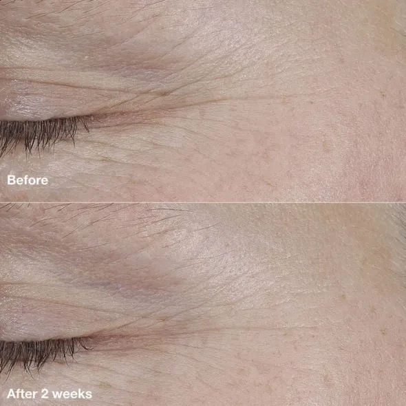 Smart Clinical Repair AM/PM Retinoid Balm