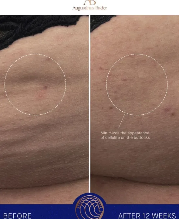 The Body Cream