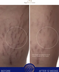 The Body Cream