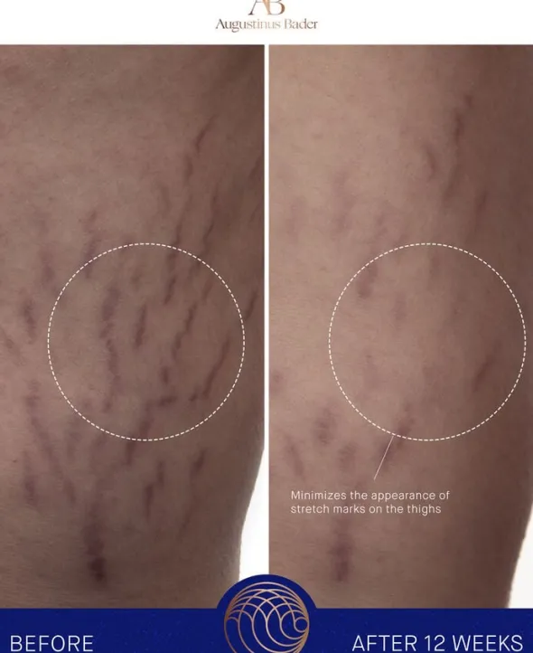 The Body Cream