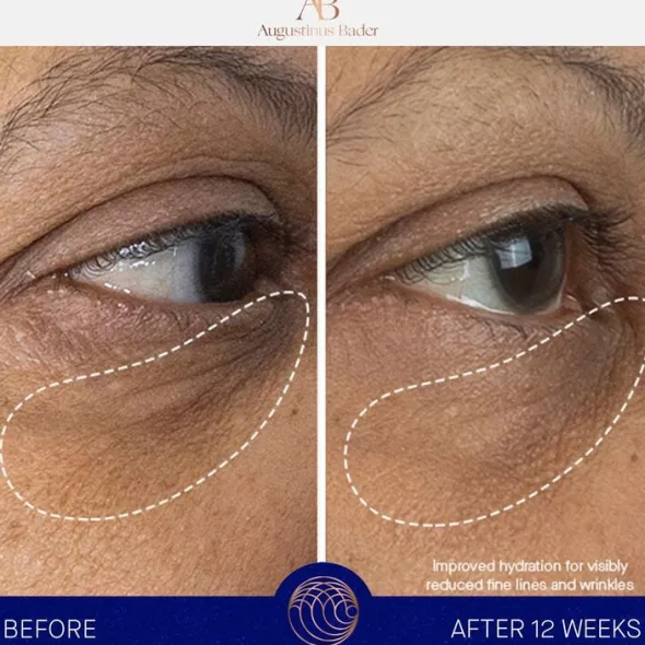 The Eye Cream Nomad 15ml