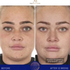 The Face Cream Mask