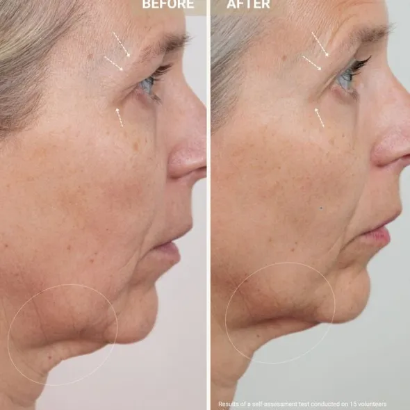 Youth Serum - Anti-aging-serum med kopparpeptider